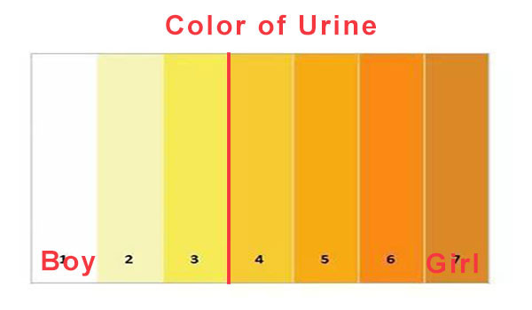 yellow urine in babies